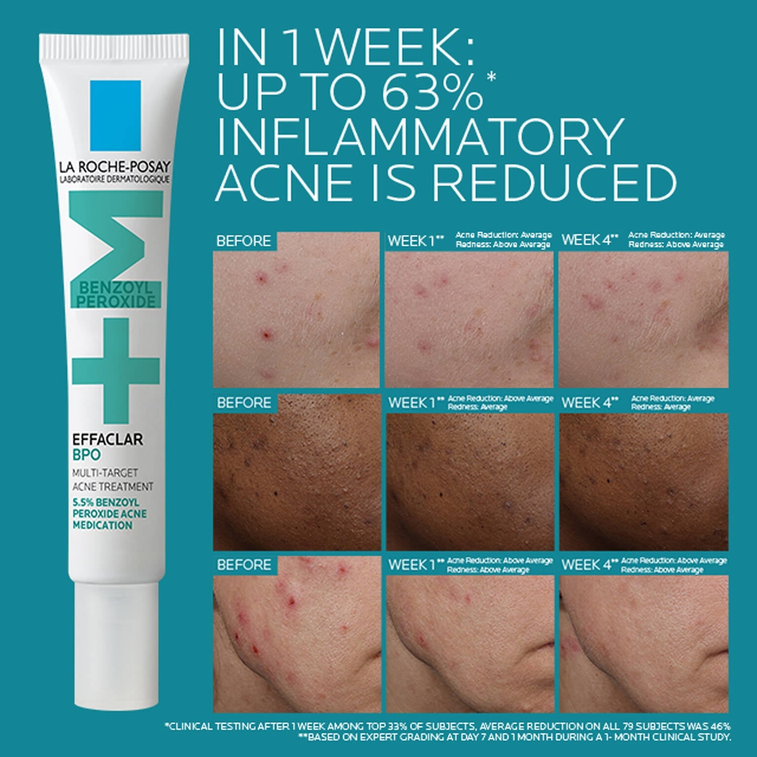 effaclar-bpo-multi-target-acne-treatment-with-5-5-benzoyl-peroxide-k4 EffaclarBPO-ClinicalBA-ATF-1500x1500-2.jpg