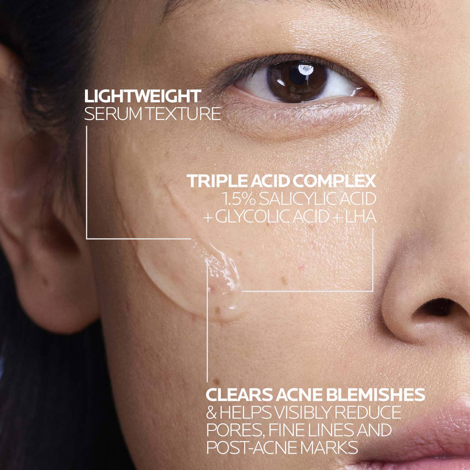 effaclar-salicylic-acid-acne-treatment-serum-x7 LaRochePosay-Product-Effaclar-Effaclar-Serum-30ml-3337875722827-Texture-REV.jpg