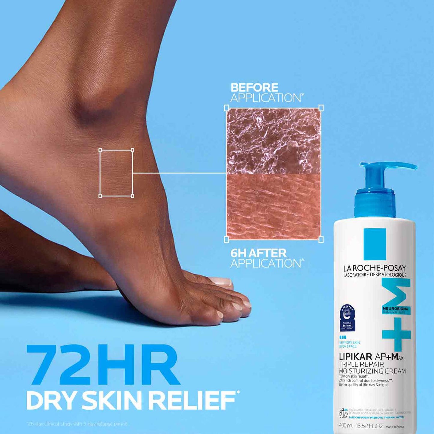 lipikar-ap-max-triple-repair-moisturizing-cream-f9 LaRochePosay-Product-Skincare-Lipikar-Balm-AP+MAX-400ml-3337875941150-ATF-PIM-BeforeAfter.jpg