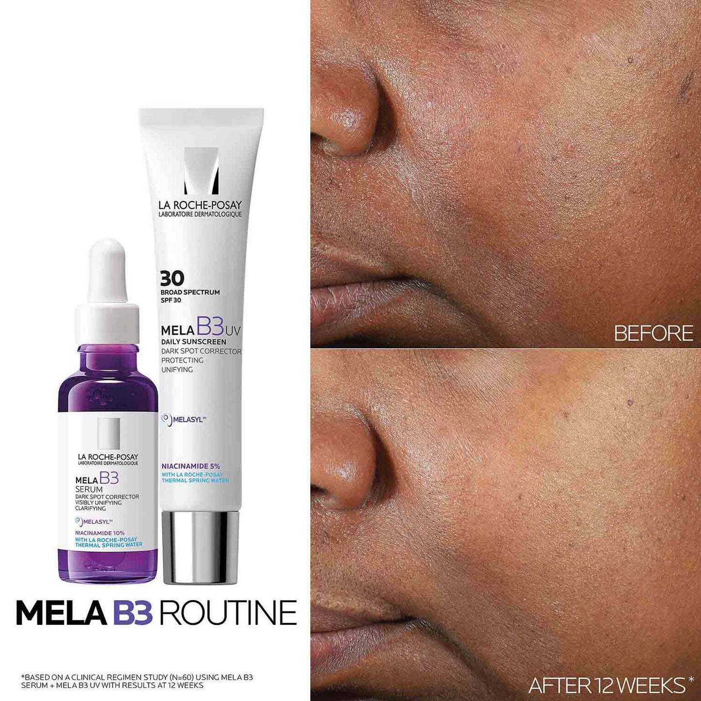mela-b3-dark-spot-serum-with-melasyltm-niacinamide-m5 Mela-B3-routine_1500X1500.jpg