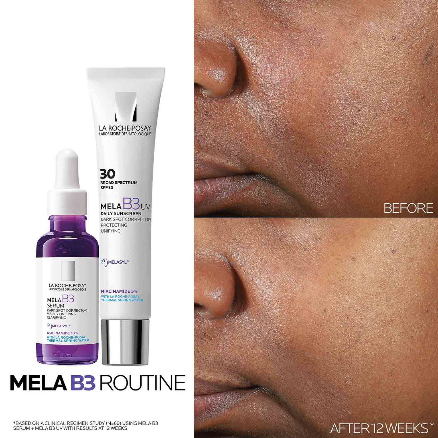 mela-b3-dark-spot-serum-with-melasyltm-niacinamide-h2 Mela-B3-routine_1500X1500.jpg